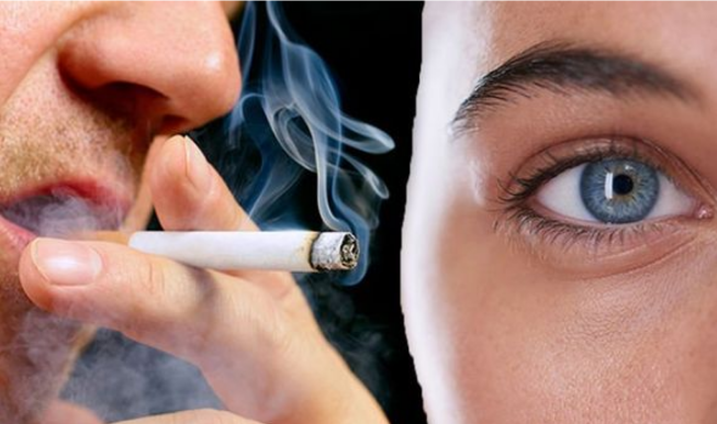 Eye Disease and Cigarette Smoking