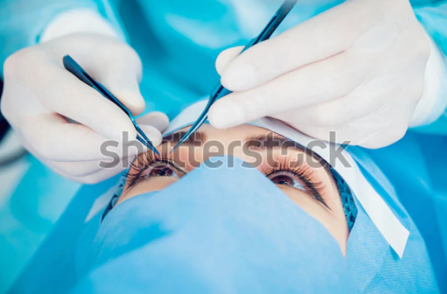 Catract Surgery